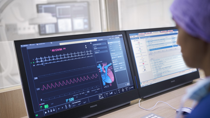 Hemodinamia con la estaci&oacute;n de trabajo IntelliVue