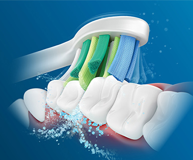 Evaluación clínica del cabezal del cepillo Philips Sonicare InterCare