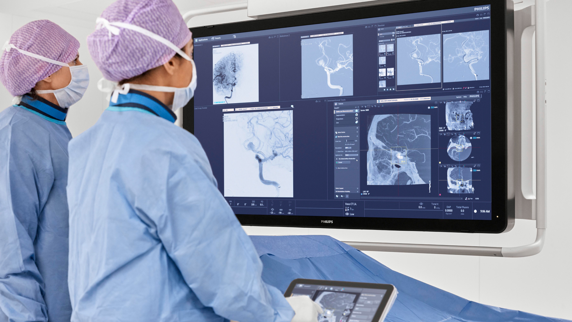 Philips est&aacute; priorizando la atenci&oacute;n del accidente cerebro vascular a nivel mundial.